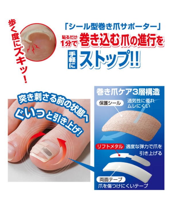 即納 巻き爪シール 1ヶ月ケア 巻き爪対策 巻き爪 対策 シール お悩み 足 シール型 巻爪 まきづめ 巻きつめ ツメ 彎曲爪 まきつめ 矯正 の通販はau Pay マーケット ヘルシーラボ