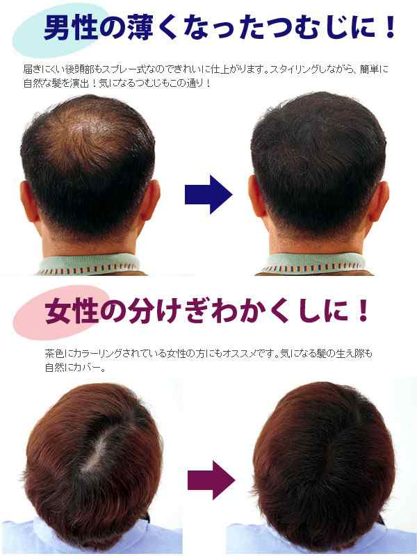 増毛スプレー【送料無料】newヘアフォロー ブラック【正規品】生え際やつむじはげ、分け目部分の薄毛をカバーする、ハゲ隠しスプレー / の通販はau  PAY マーケット - キレイサプリ