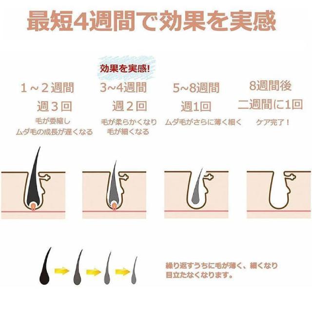 脱毛器 女性 メンズ 髭 vio対応 脱毛機 脱毛 光 家庭 痛くない ムダ毛 除毛 美肌 美白 腕 脚 脇毛 ヒゲ 全身脱毛 プレゼント_11