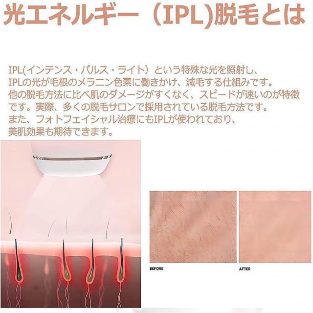 脱毛器 女性 メンズ 髭 vio対応 脱毛機 脱毛 光 家庭 痛くない ムダ毛 除毛 美肌 美白 腕 脚 脇毛 ヒゲ 全身脱毛 プレゼント_4