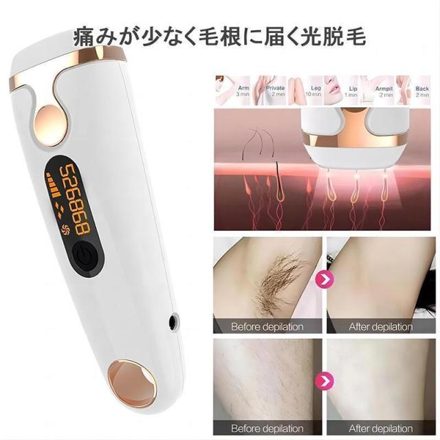 脱毛器 女性 メンズ 髭 vio対応 脱毛機 脱毛 光 家庭 痛くない ムダ毛 除毛 美肌 美白 腕 脚 脇毛 ヒゲ 全身脱毛 プレゼント_8