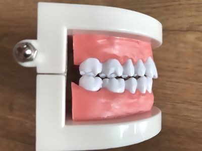 置物 歯の模型 リアル 歯医者さん風 角度調節可能の通販はau Pay マーケット ノイシュタット