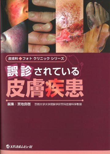 誤診されている皮膚疾患 (皮膚科・フォトクリニックシリーズ)(中古品)