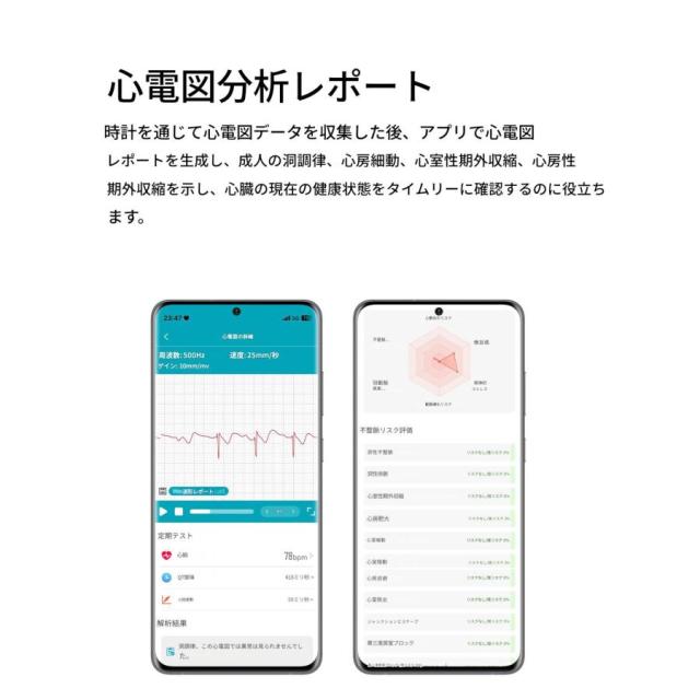 スマートウォッチ 通話機能 ECG心電図 血圧測定 血中脂質 尿酸 AI診断 皮膚温 高精度心拍数 血中酸素 睡眠 着信通知 24時間健康管理 SOS_3
