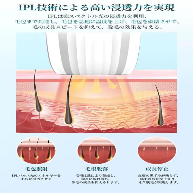 脱毛器 IPL光脱器 永久脱毛 家庭用脱毛器 自動照射 レーザー vio対応 メンズ レディース 脇 腕 足 背中 全身用 LED液晶 全身適用_4