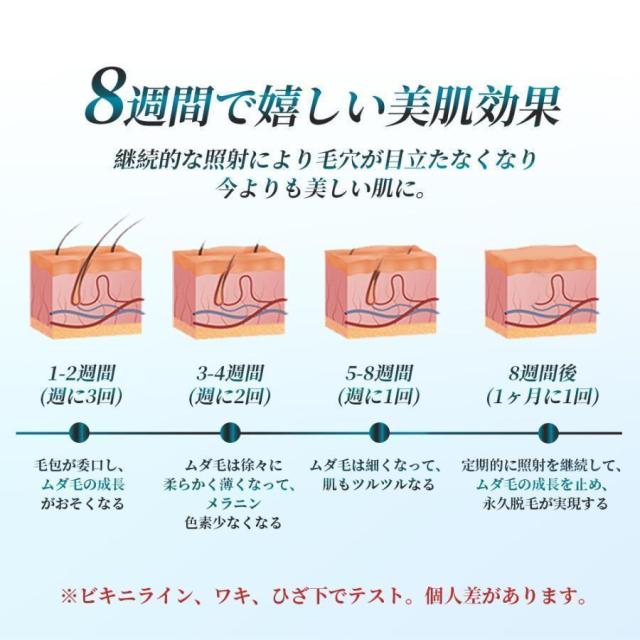 脱毛器 IPL光脱器 永久脱毛 家庭用脱毛器 自動照射 レーザー vio対応 メンズ レディース 脇 腕 足 背中 全身用 LED液晶 全身適用_8