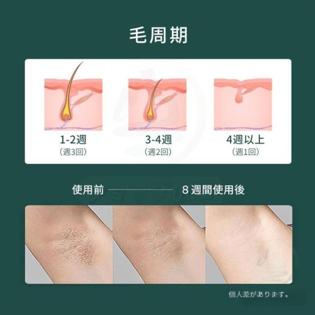 脱毛器 脱毛機 ipl光脱器 無痛脱毛器 サロン級 女性 メンズ 5段階調節 自動照射 無制限照射 レーザー vio対応 メンズ レディース 脇 腕 足 背中 全身用 快速脱毛_8