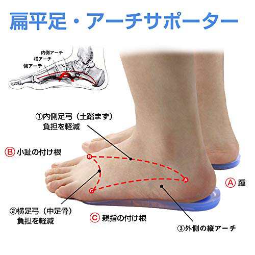 インソール, 足底筋膜炎 インソール かかと クッション