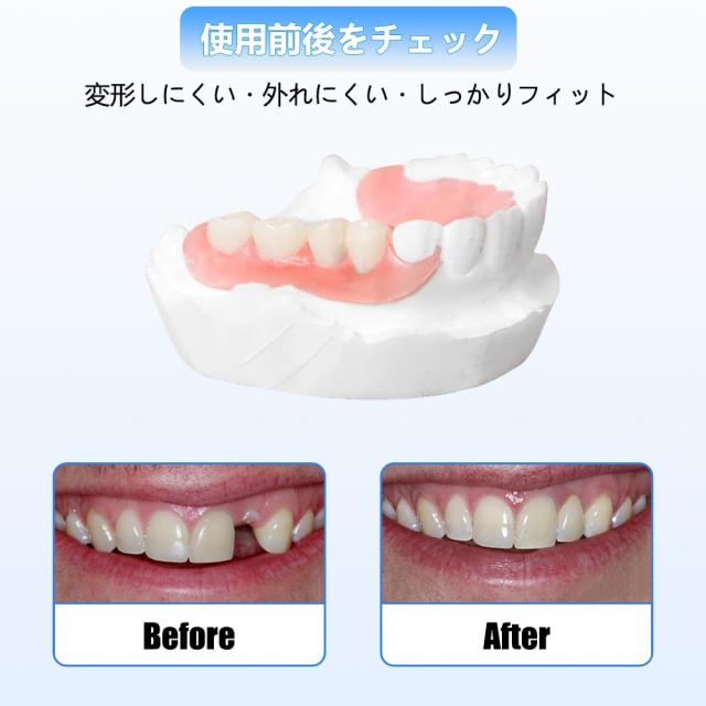 7本 カスタム 入れ歯 部分 取り外し可能 Dentellea 義歯 自然な見た目