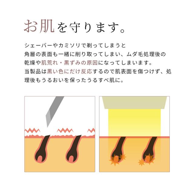 VELVEST 脱毛器 光美容器 VIO 髭 フラッシュ家庭用 自動照射 アンダー