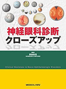 神経眼科診断クローズアップ(中古品)