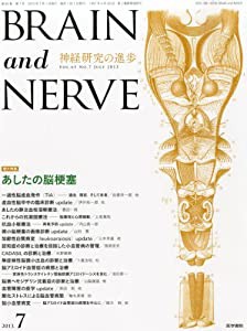 BRAIN and NERVE 2013年7月増大号 増大特集 あしたの脳梗塞(中古品)