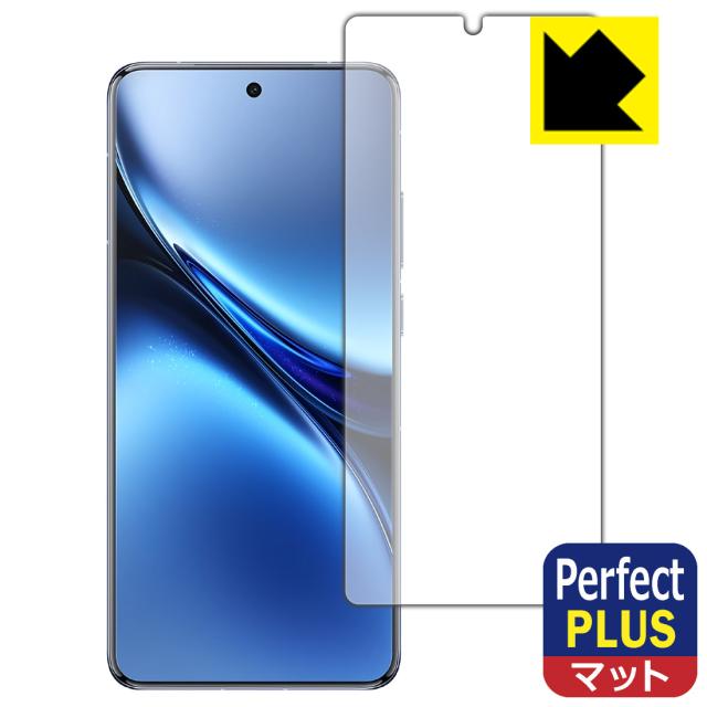 Perfect Shield Plus【反射低減】保護フィルム vivo X200 Pro 【指紋認証対応】【PDA工房】