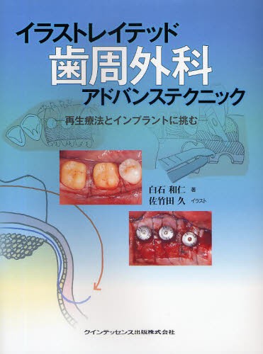 イラストレイテッド歯周外科アドバンステクニック 再生療法と