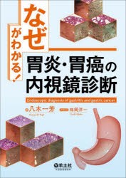 「なぜ」がわかる!胃炎・胃癌の内視鏡診断 [本]