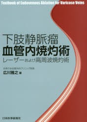 下肢静脈瘤の血管内焼灼術（レーザー・高周波治療）｜東京都台東