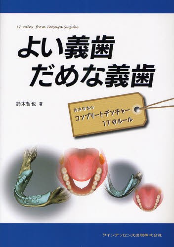 よい義歯 だめな義歯 | 鈴木 哲也 |本 | 通販 | Amazon