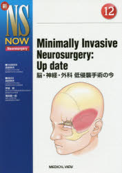 Minimally Invasive Neurosurgery：Up date 脳・神経・外科低侵襲手術の今 [本]の通販は 9,196円