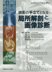 超」入門脳血管内治療 セットアップ・血栓回収からFDまで会話