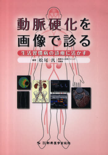 動脈硬化を画像で診る 生活習慣病の診療に活かす [本]の通販は 5,143円