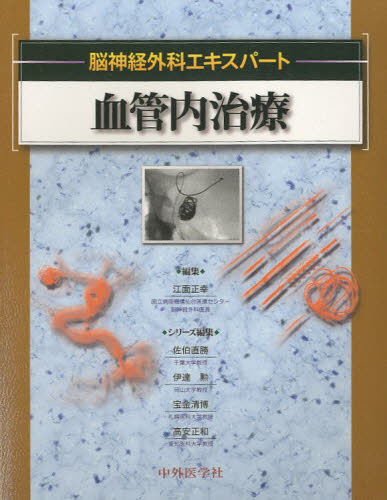 脳神経血管内治療次の一手 専門医・指導医のための難症例解決指南 血管内治療 [本] 脳神経血管内治療 次の一手: 専門医・指導医のため