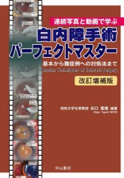 白内障手術パーフェクトマスター 連続写真と動画で学ぶ 基本から難症例への対処法まで [本]