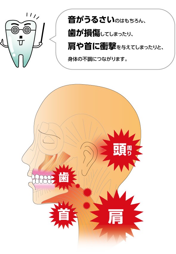 歯ぎしりの悩み