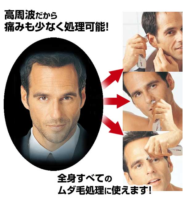 高周波だから痛みも少なく処理可能