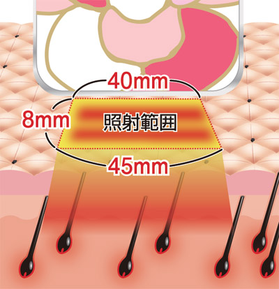 キセノンフラッシュ