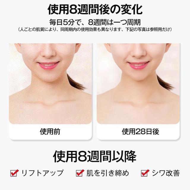 medibelle 美容ローラー EMS リフトアップ medibelle 美容ローラー EMS リフトアップ