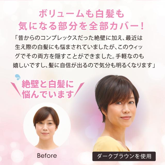 ナチュウィッグ KOGAO ブラウン (巾着付き) (送料無料 ボリュームアップ 小顔効果 白髪隠し UV 抗菌仕様 人工皮膚ネット)《ティーライフ》