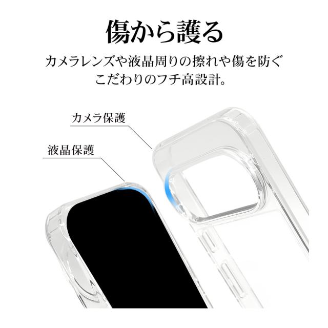 詳細