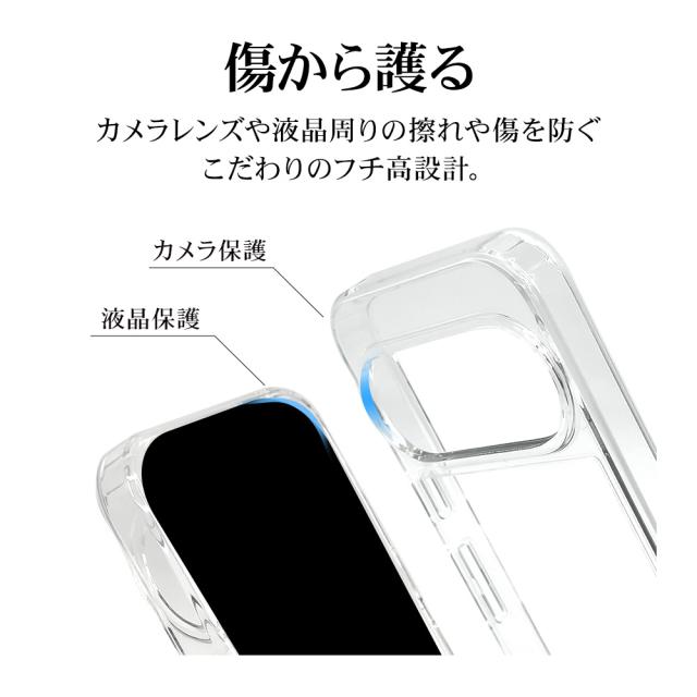 詳細