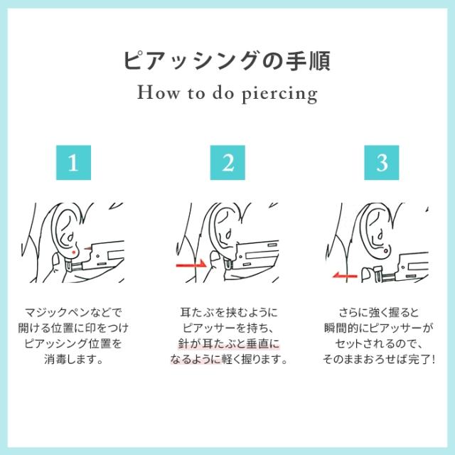 金属アレルギー対応