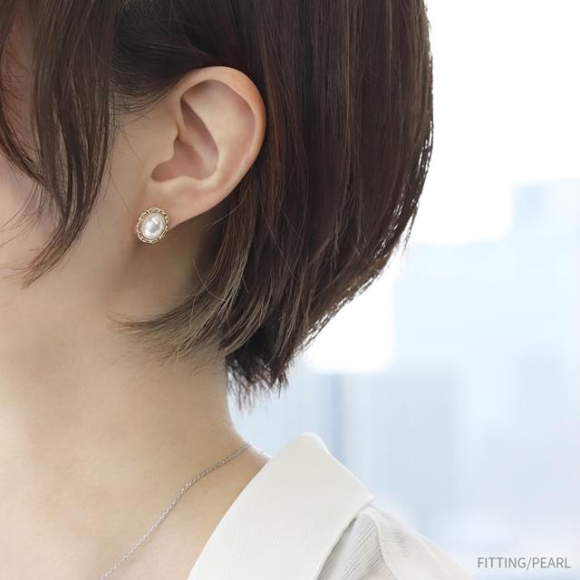 アレルギーが起きにくいチタン