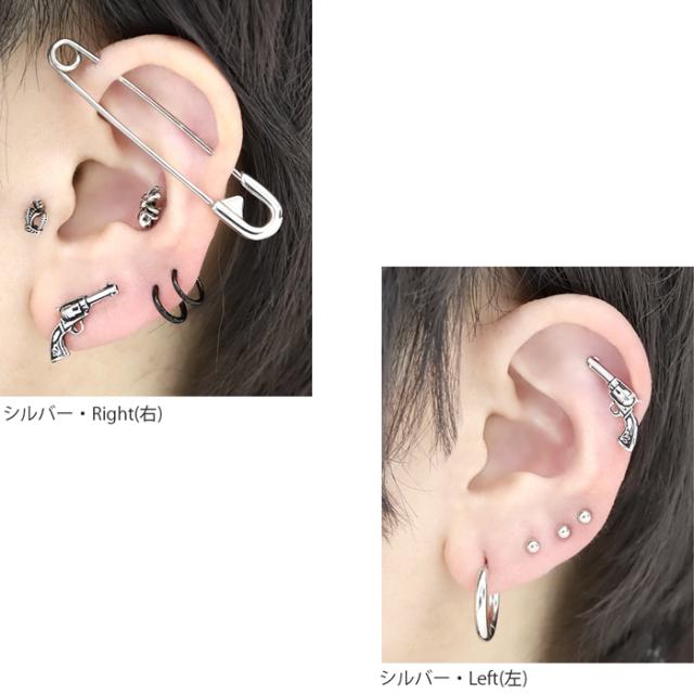 金属アレルギー対応