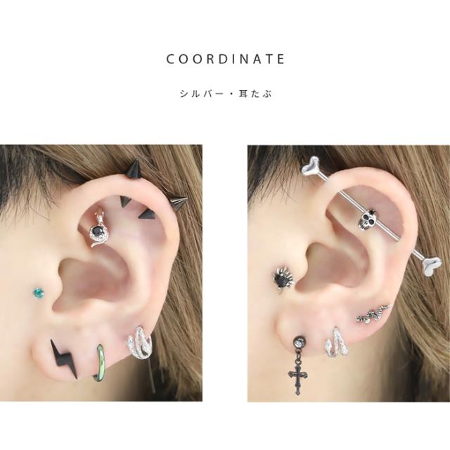 アレルギー対応