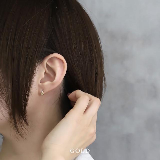 金属アレルギー対応