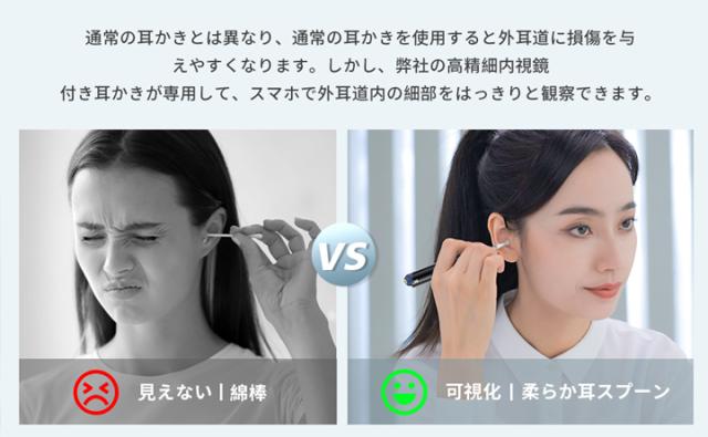 耳鏡 IBebird T15 Bebird X3 Bebird P30