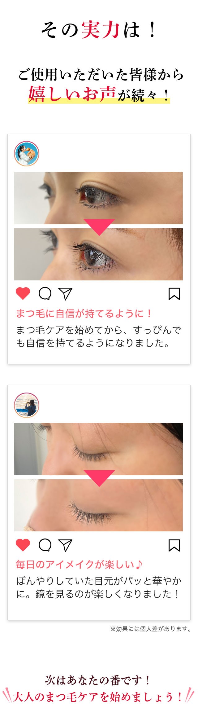 まつ毛美容液 ソワニティーデュアルアイラッシュセラム 1本 4ml まつ毛