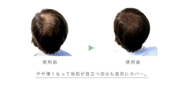 薄毛使用前・使用後