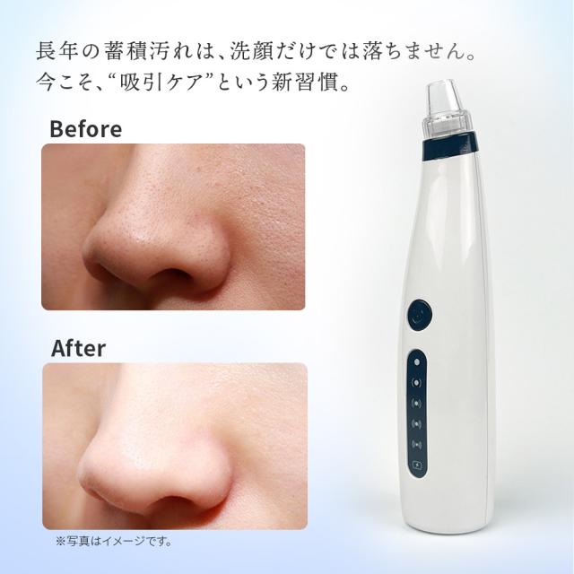 毛穴吸引器 毛穴ケア 鼻 毛穴 黒ずみ 毛穴汚れ いちご鼻 イチゴ鼻 毛穴吸引機 スキンケア 