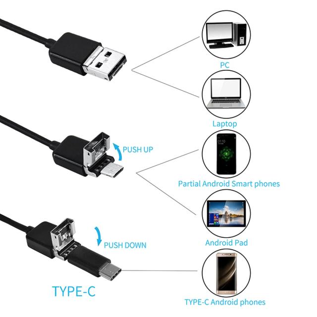 デジタル内視鏡