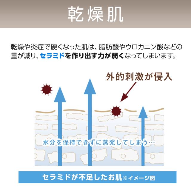 乾燥肌はセラミドを作り出す力が弱くなってしまい外的刺激が侵入