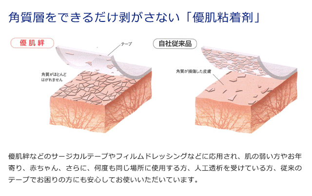 赤ちゃんや肌の弱い人にもおすすめの優肌粘着剤使用