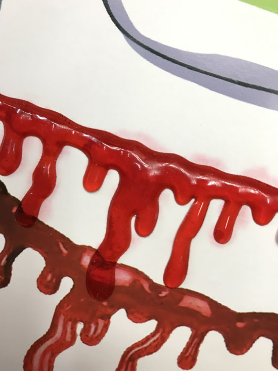 出血チョーカー