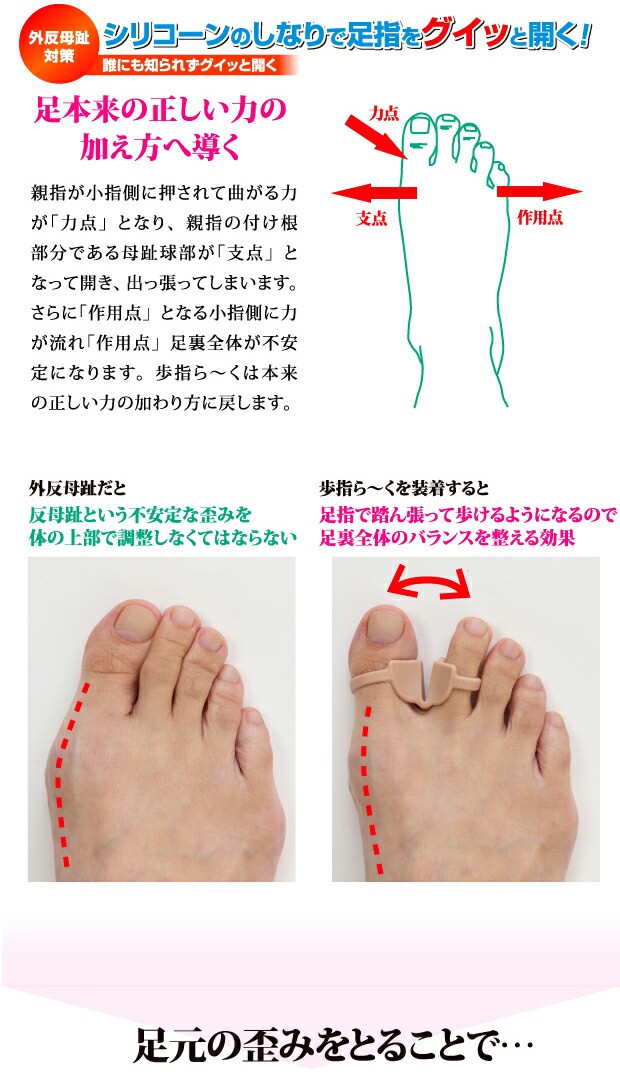 外反母趾 矯正 グッズ 外反パッド 歩指ら く ぼしら く のしなりで痛ーい 足 本物 シリコーン