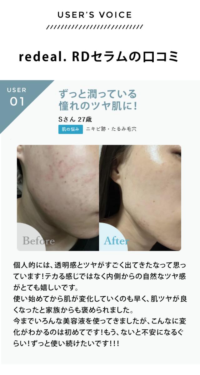 redeal. RDセラム 30ml リディアル
