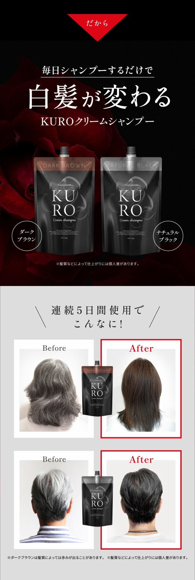 セットで1個あたり418円お得】バランローズ KUROクリーム