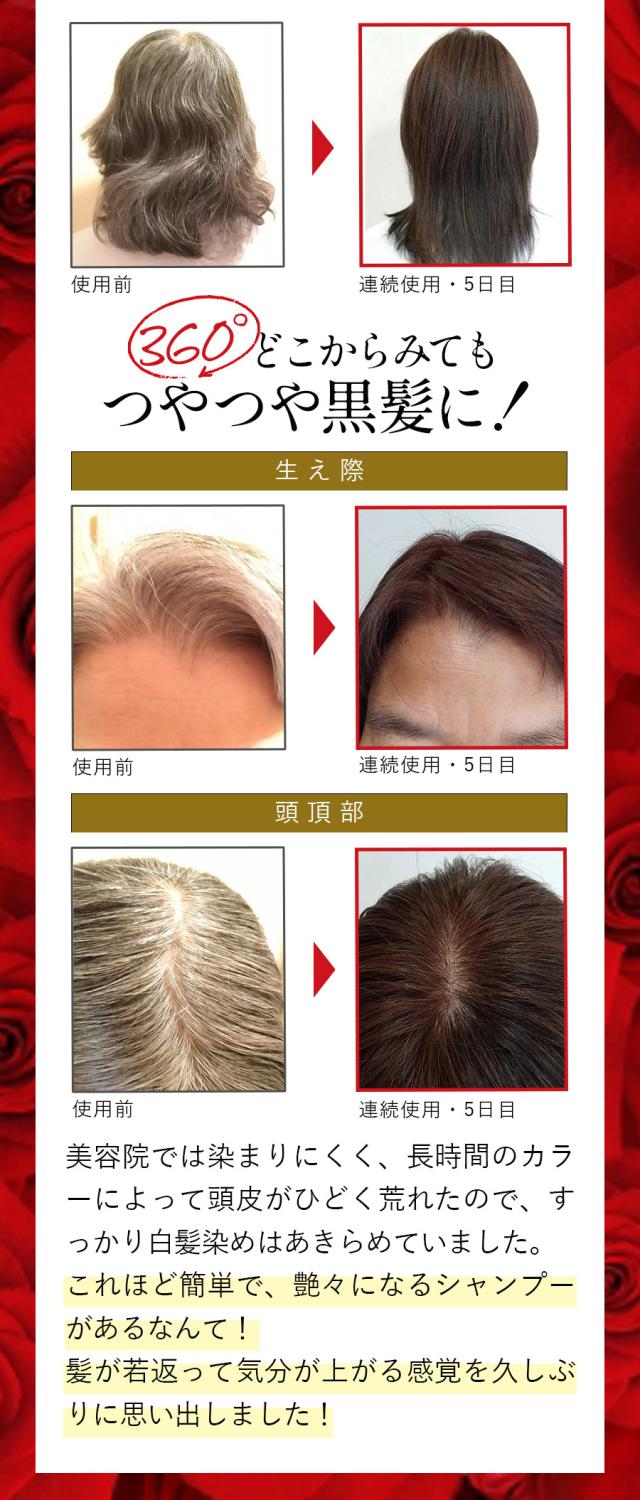 格安 バランローズ Kuroクリームシャンプー 在庫限りセール Carlavista Com